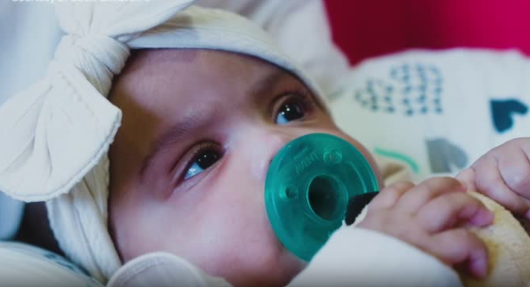 Texas conjoined twin returns home after successful separation surgery from sister