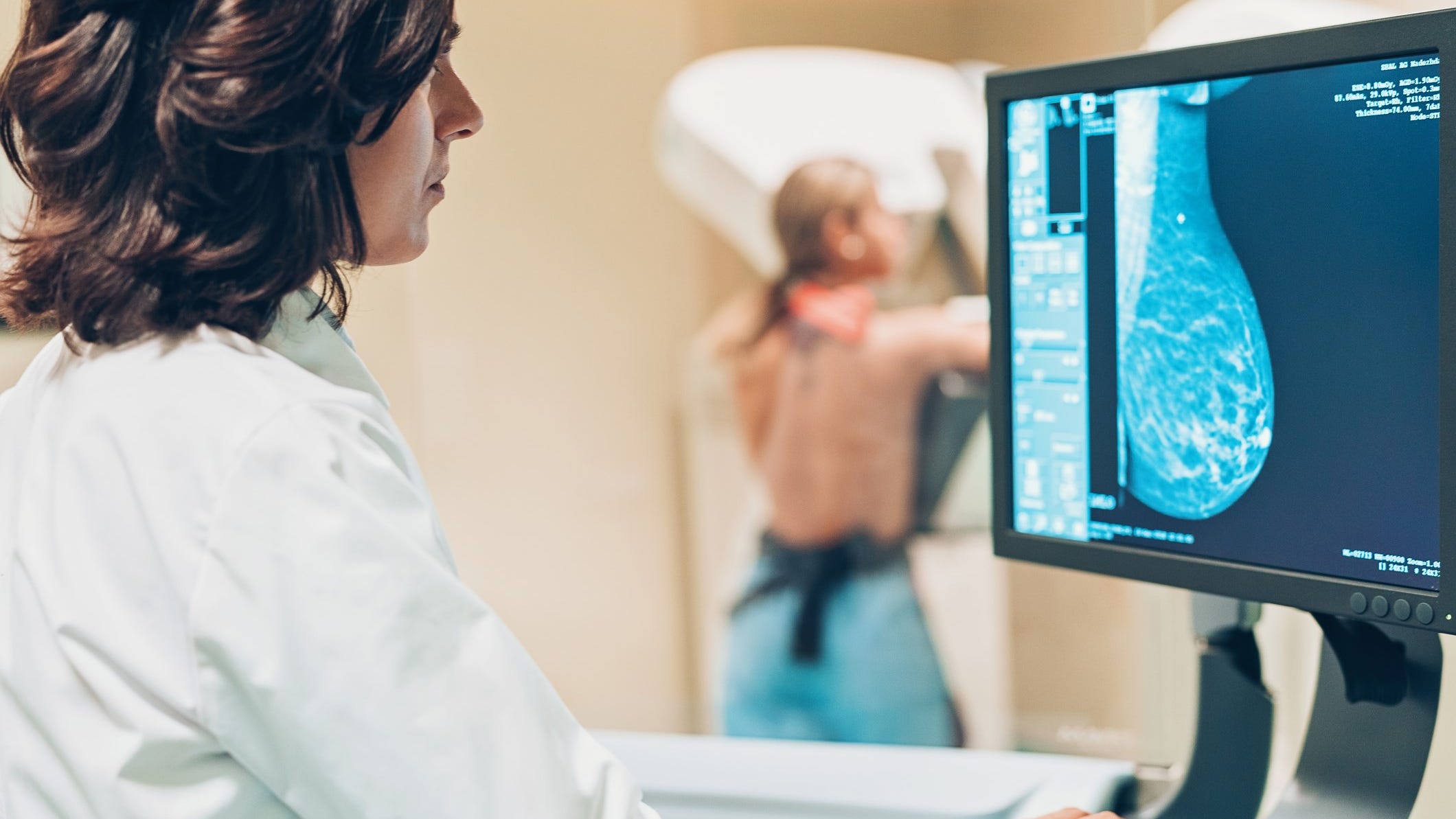The U.S. Preventive Services Task Force changed its mammography screening guidelines in 2009 to recommend that routine breast cancer screening start at age 50 rather than age 40.