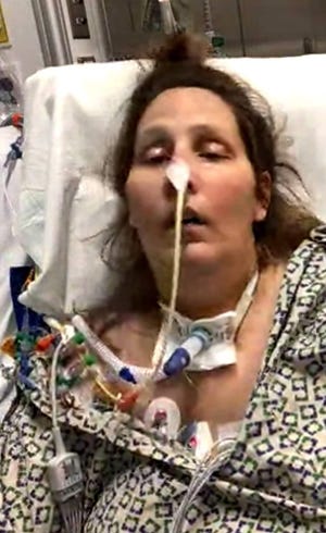 Bianca Arnold, a mother of two who was hospitalized due to COVID, intubated and then in a coma. She was in a come for 40 days and spent an additional 40 days hospitalized once she woke up.