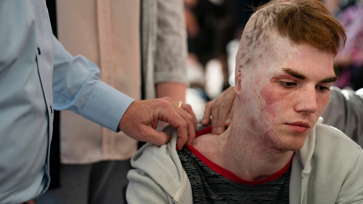 Un garçon ukrainien “était en train de mourir sur la table d’opération et ils l’ont sauvé”