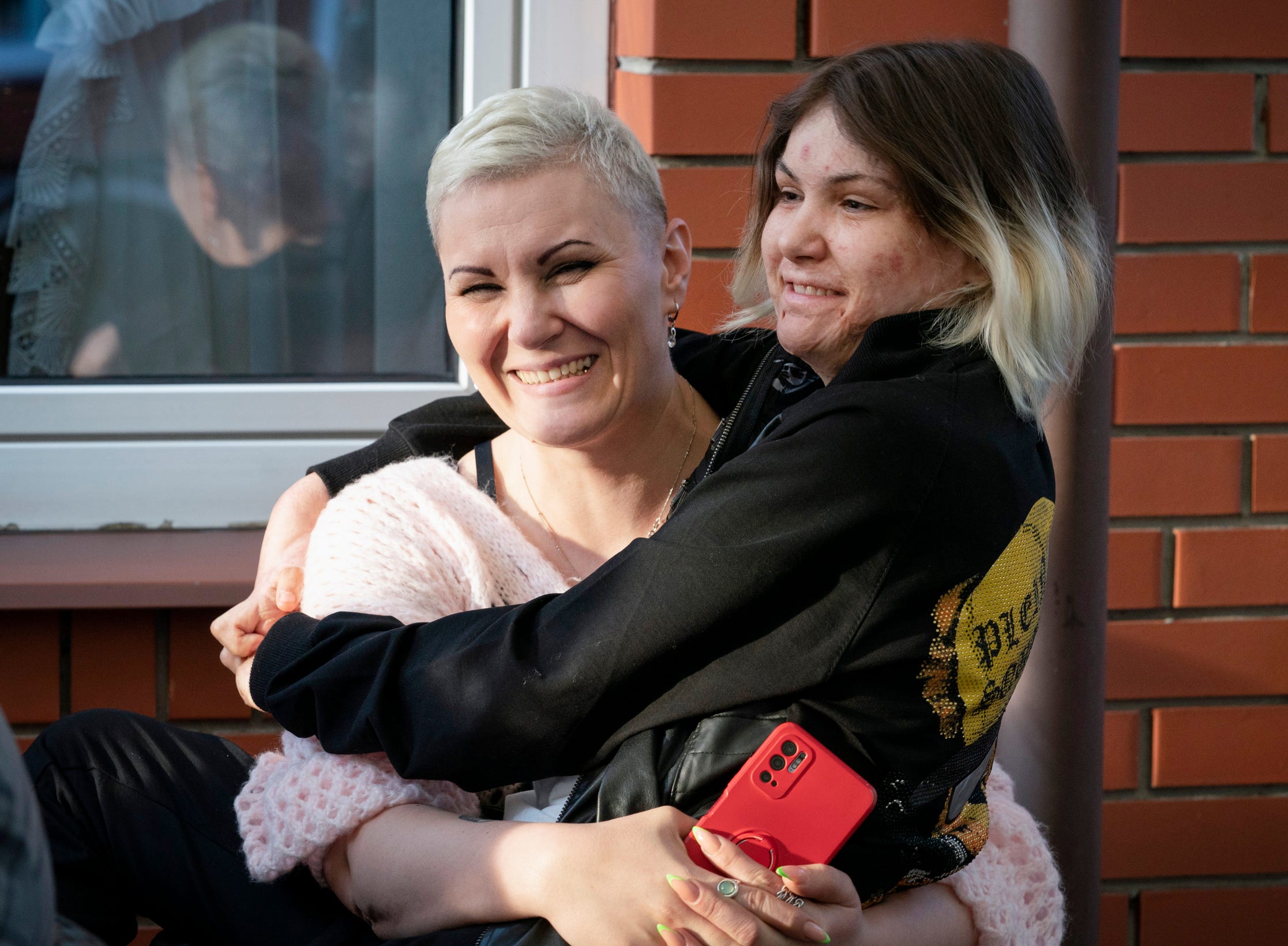 Vitalina Petrenko, 38, holds her daughter Karolina Petrenko,16, originally from Cherkasy, Ukraine but now live in Warsaw after evacuating from Ukraine due to the war as they wait to be seen by doctors to screen Karolina for a surgery on her burn scar tissue to free her fingers on both of her hands as they wait at a hotel in Leczna, Poland on Sunday, May 14, 2023. Karolina suffered burns over 75 percent of her body when she was shocked by a current of a passing train on Sept. 9, 2019 while taking a selfie.