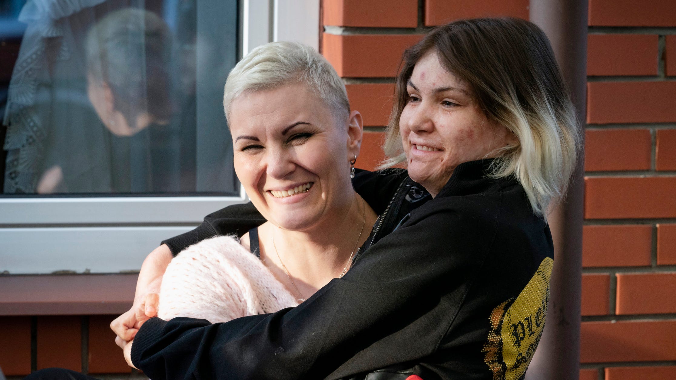 Vitalina Petrenko, 38, holds her daughter Karolina Petrenko,16, originally from Cherkasy, Ukraine but now live in Warsaw after evacuating from Ukraine due to the war as they wait to be seen by doctors to screen Karolina for a surgery on her burn scar tissue to free her fingers on both of her hands as they wait at a hotel in Leczna, Poland on Sunday, May 14, 2023. Karolina suffered burns over 75 percent of her body when she was shocked by a current of a passing train on Sept. 9, 2019 while taking a selfie.