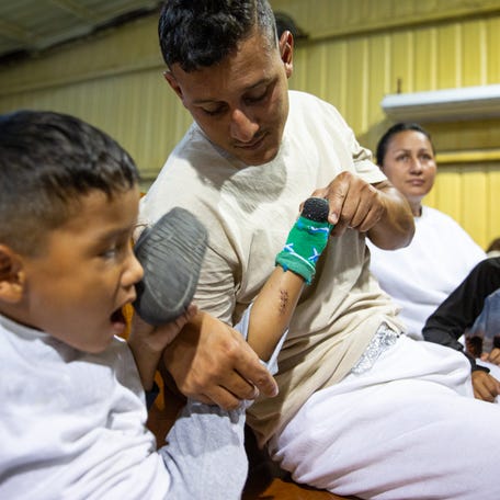 Omar Tortua, 27, from Venezuela, lifts his 5-year-old son Jesús' pant leg to show a 2-inch laceration he sustained from razor wire crossing the Rio Grande, at Mission: Border Hope on Friday, July 21, 2023, in Maverick County, Texas. 